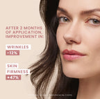 Hyaluron Activ Procedure Retinal Lifting Cream - 0.1% Retinal